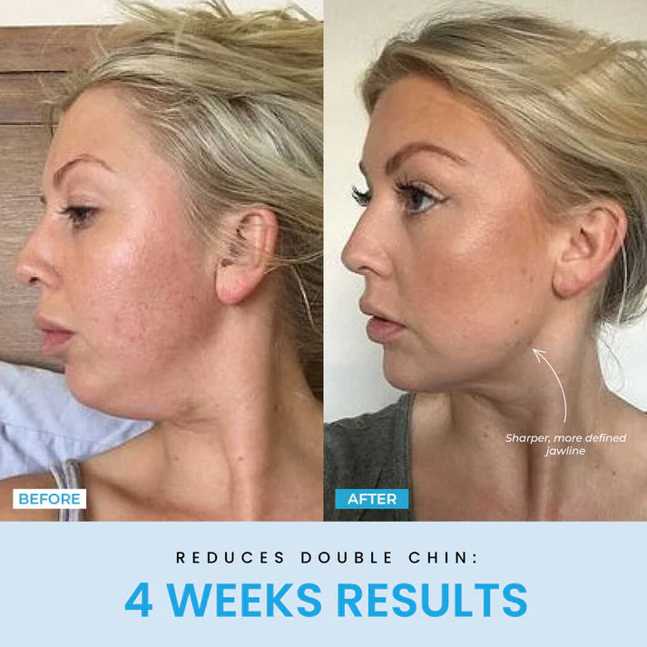 VeroLift™ — Reveal a Sculpted Jawline and Radiant Glow in Minutes Daily - Image 5