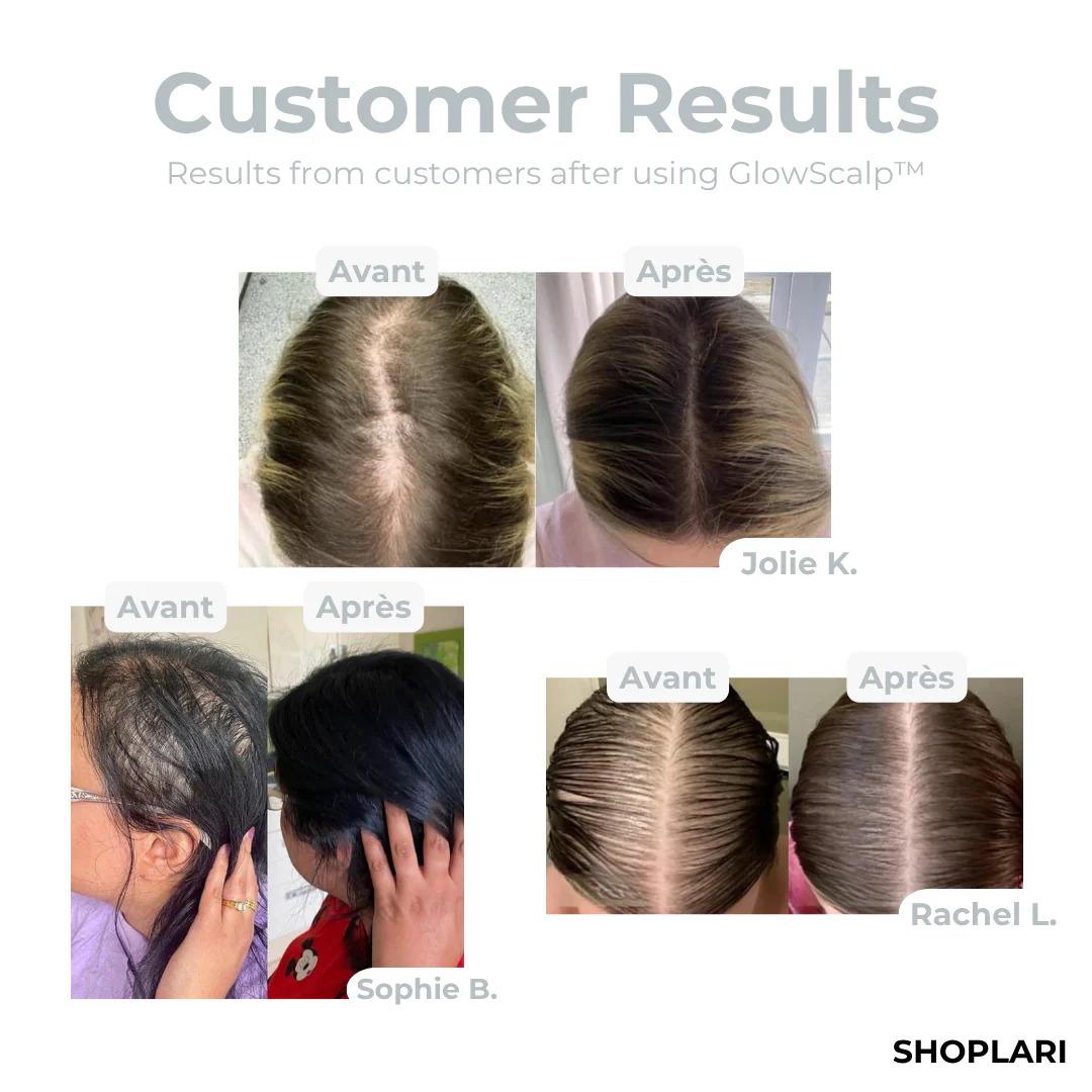 VioraLume™ — Revive Your Hair, Calm Your Mind, and Shine with Confidence - Image 3