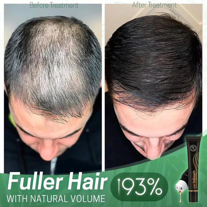ViraCrest™ — Transform Your Thinning Hair Into a Lush, Head-Turning Crown - Image 3