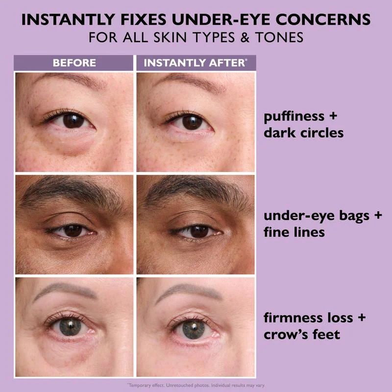 VisiLift™ Instant Eye Tightener – Look Younger in Minutes, Lasts All Day - Image 5