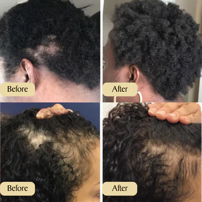 VitalBlossom™ Natural Hair Growth Oil - Image 7