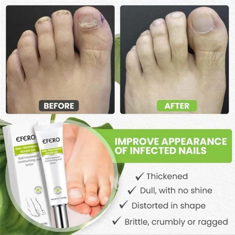 VitaNail™ — Heal and Strengthen Nails Fast for Head-Turning Confidence - Image 3