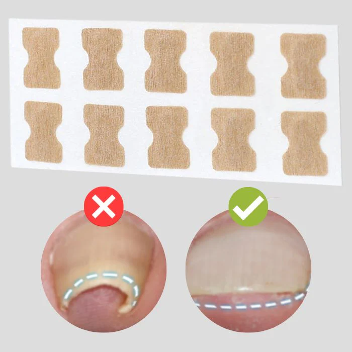 VitaNailPro™ — End Toenail Pain and Flaunt Beautiful, Confident Bare Feet Again! - Image 2