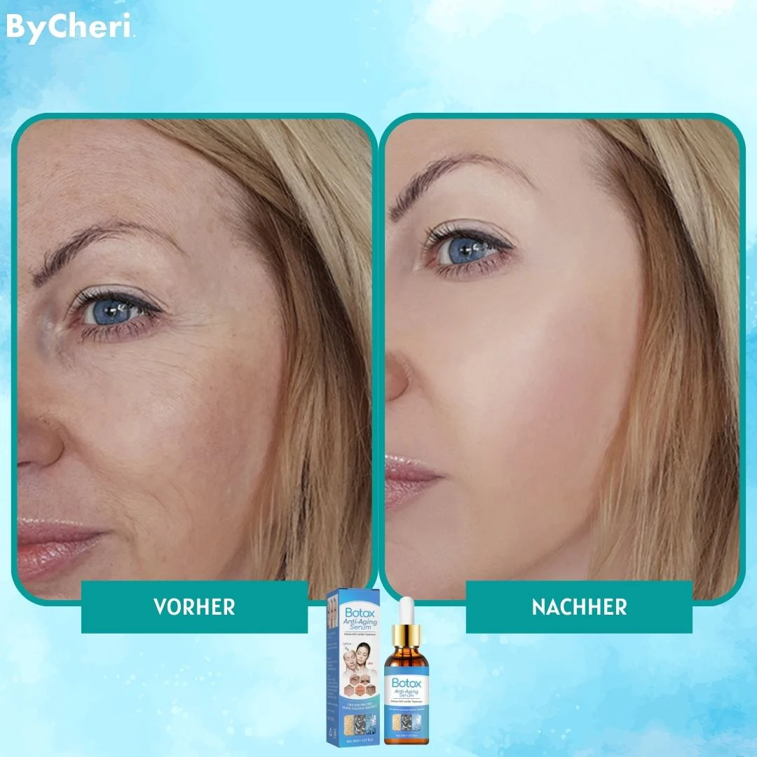 VivaLuxe™ — Unlock Youthful Radiance and Ditch Wrinkles Without Pain or Needles - Image 3
